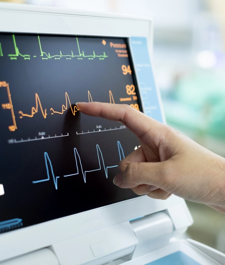 holter ekg